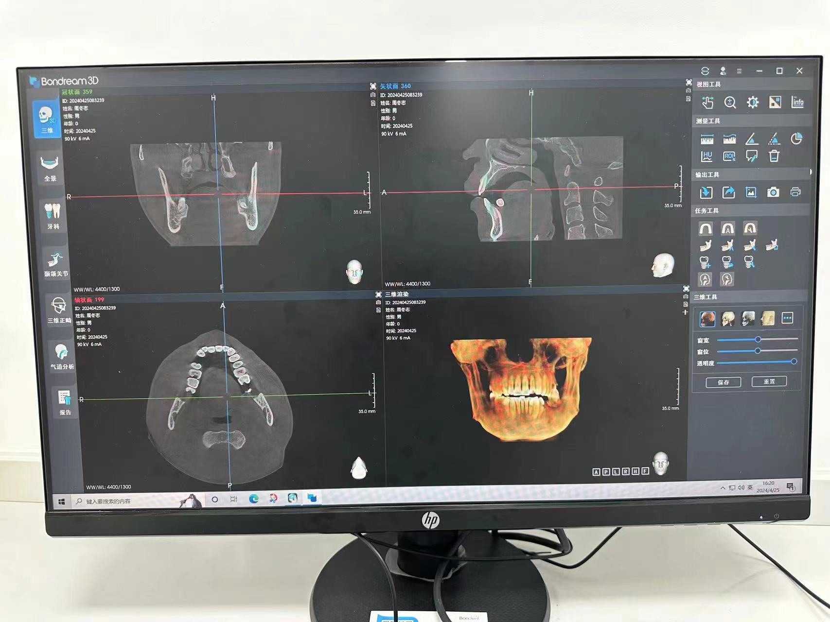 二手口腔CBCT博恩登特20臺(tái)